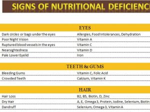 Signs of Nutritional Deficiencies